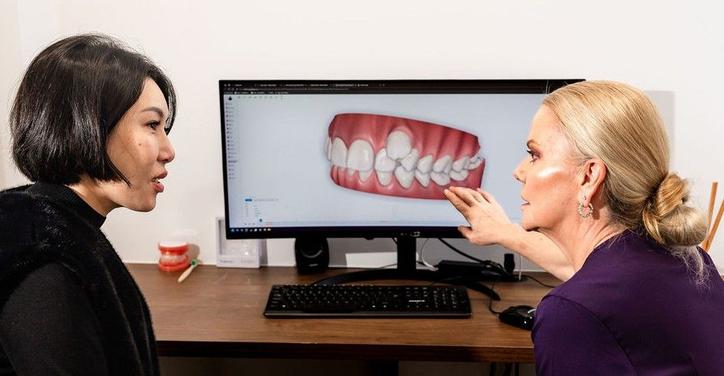 angel aligners preview.jpg