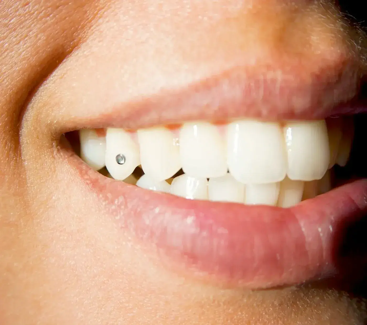 Tooth Jewellery card image