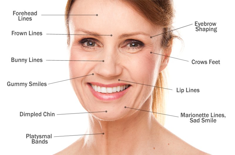 Smiles with Cosmetic Injectables