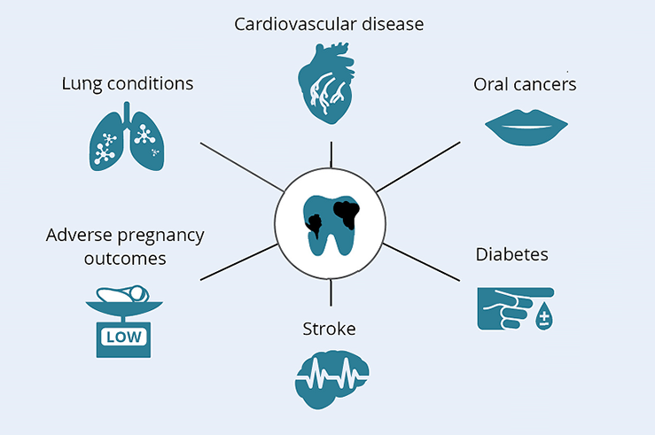 oral systemic link