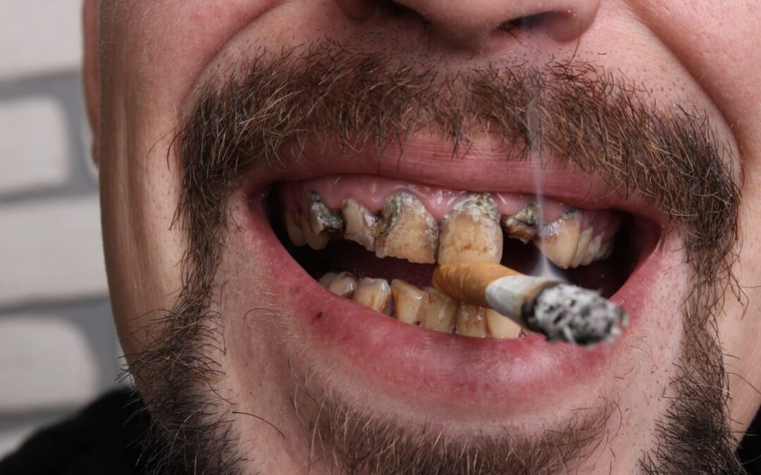 How Cigarettes Impact Your Oral Health