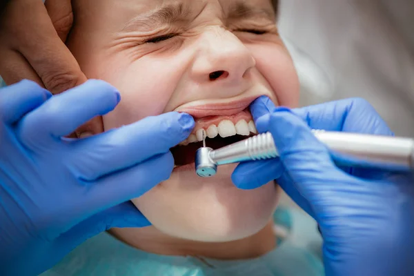 Overcoming Childhood Dental Trauma