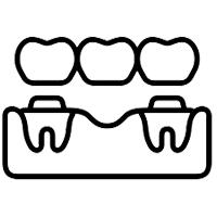 bridge renew dental lounge