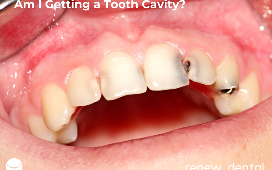 How Can You Tell If You Have a Cavity?